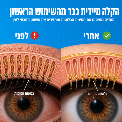 Mistly+ - מכשיר אדים חכם לעיניים יבשות